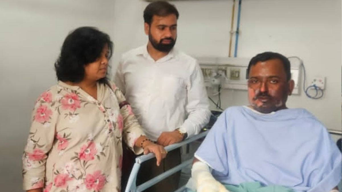 कुसुम स्मेल्टर्स प्लांट में फिर हादसा, गर्म स्पंज आयरन की चपेट में आने से 3 कर्मचारी झुलसे